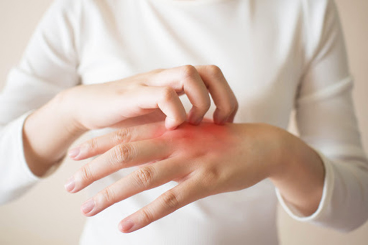 What Is Pruritus (Itchy Skin)? Symptoms, Causes And Recommendations